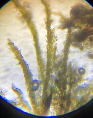 Ephemerum spinulosum