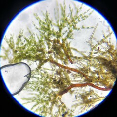 Ephemerum spinulosum