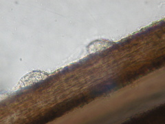 Catenophlyctis variabilis