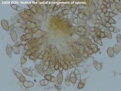 Puccinia glechomatis