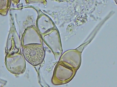 Puccinia glechomatis