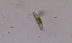 Cymbella