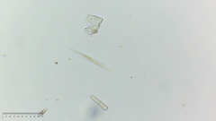 Fragilaria