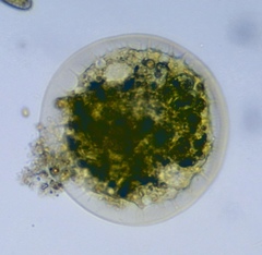 Arcella vulgaris