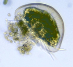 Arcella vulgaris