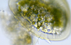 Arcella vulgaris