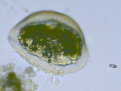 Arcella vulgaris