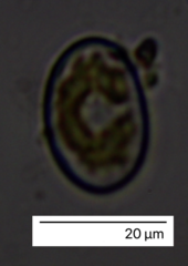 Cocconeis