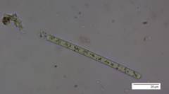 Planktothrix