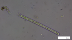 Planktothrix