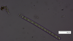 Planktothrix