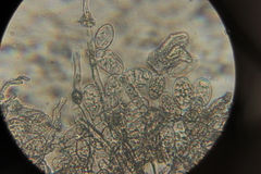 Erysiphe knautiae