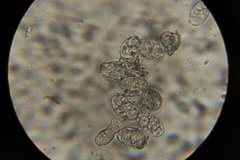 Erysiphe knautiae