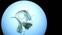 Drepanocladus