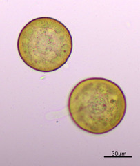 Arcella hemisphaerica