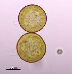 Arcella hemisphaerica