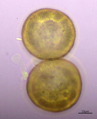 Arcella hemisphaerica