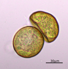 Arcella hemisphaerica