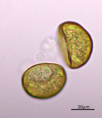 Arcella hemisphaerica