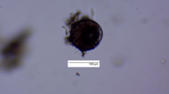 Amoebozoa