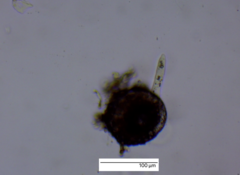 Amoebozoa