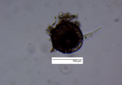 Amoebozoa