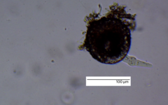 Amoebozoa