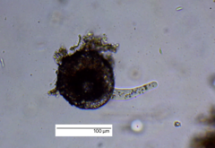 Amoebozoa