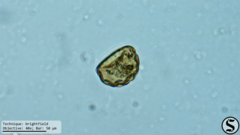Arcella gibbosa