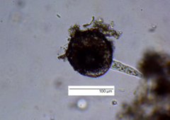 Amoebozoa