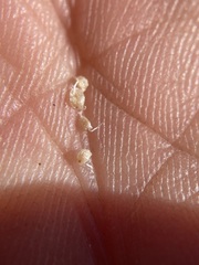 Triantha occidentalis