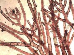 Callithamnion tetricum