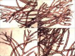 Callithamnion tetricum