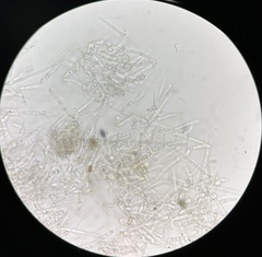 Hypomyces tubariicola