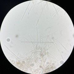 Hypomyces tubariicola