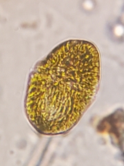 Dinoflagellata