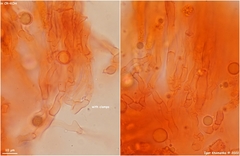 Clavulina rugosa