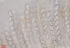 Peziza griseorosea