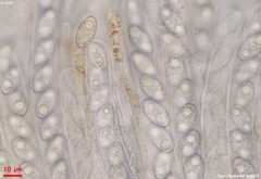 Peziza griseorosea