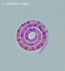 Acanthohelicospora aurea