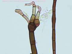 Acanthohelicospora aurea