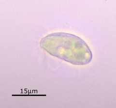 Cyclidium glaucoma