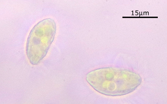 Cyclidium glaucoma