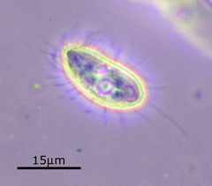 Cyclidium glaucoma