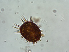 Trachelomonas armata