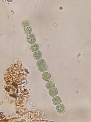 Anabaena