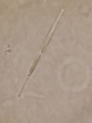 Monoraphidium griffithii