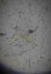 Nematoda