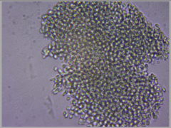 Microcystis