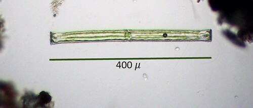 Pleurotaenium subcoronulatum